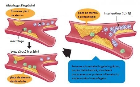 Infografic care arată cum crește placa de aterom