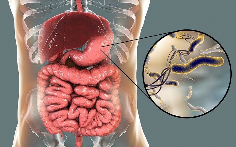 Regim alimentar Helicobacter pylori: ce să mâncați și ce să evitați?